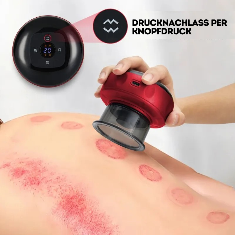 Smart Cupping - Massage Gerät